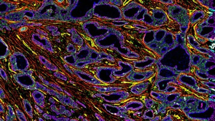bioindustry_380x215_m0eyyk4p.jpg